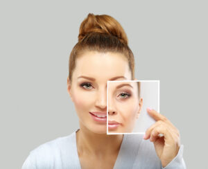 facial balancing dermal fillers denver